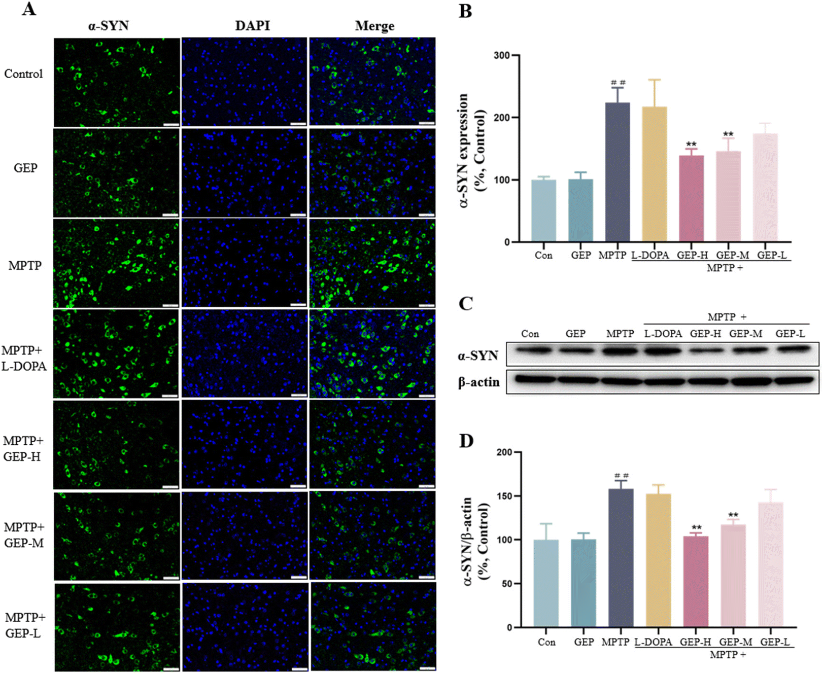 Gastrodia elata polysaccharide alleviates Parkinson's