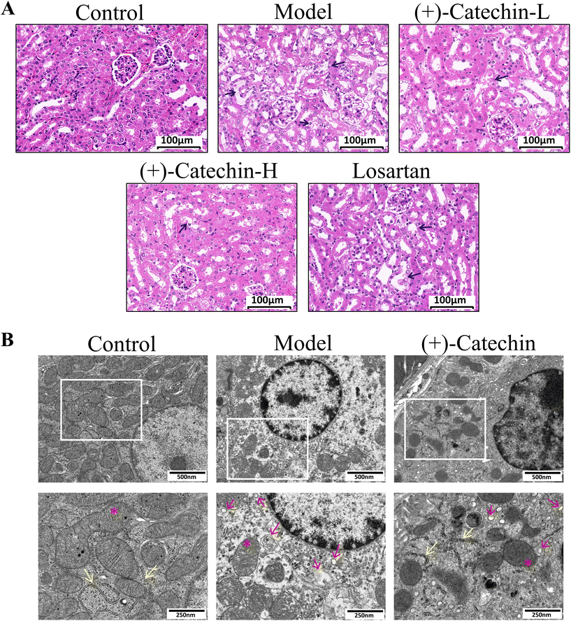 Catechin ameliorates diabetic nephropathy injury by inhibiting