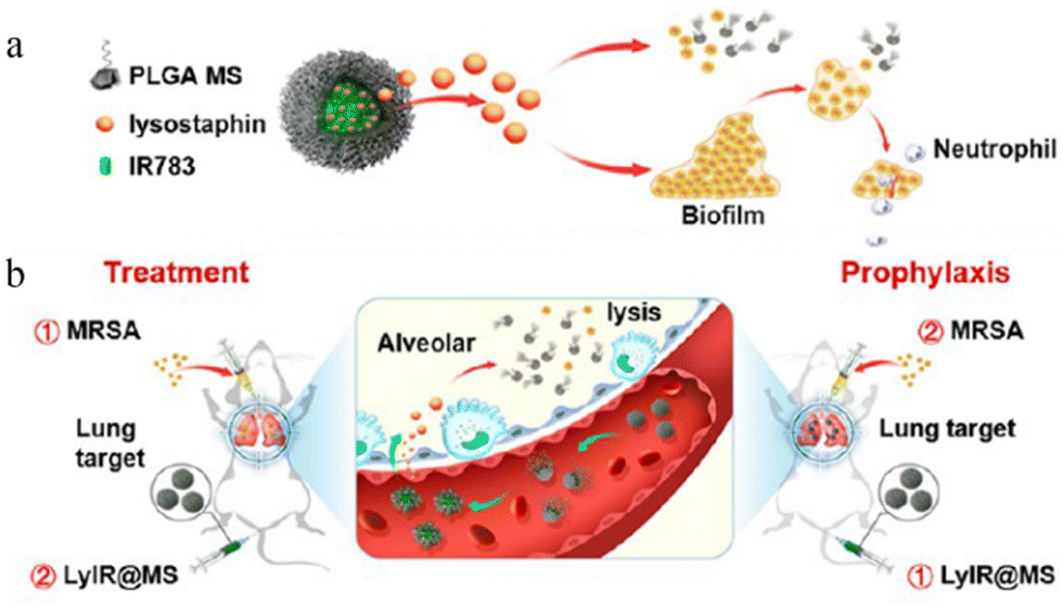 Application of biodegradable microsphere injections: an anticancer ...