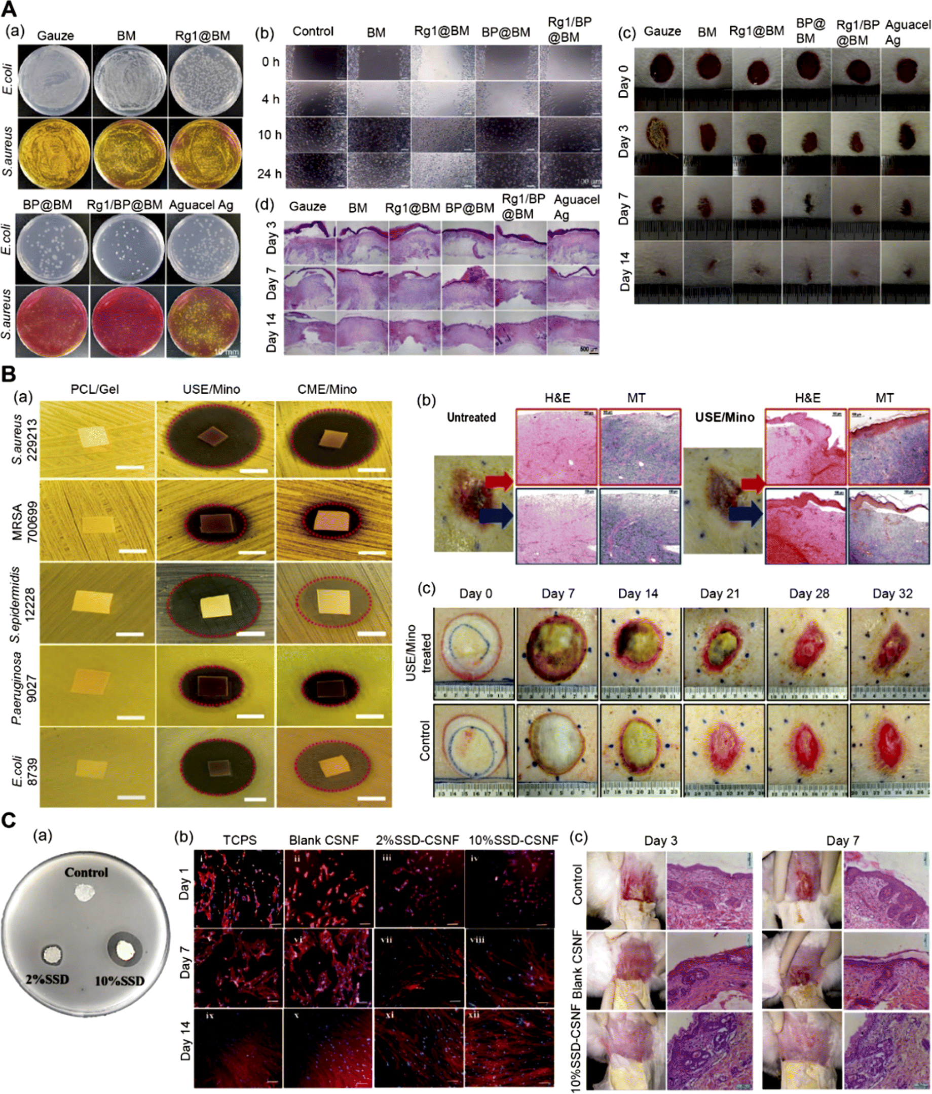 Recent progress of electrospun nanofibers as burning dressings - RSC ...