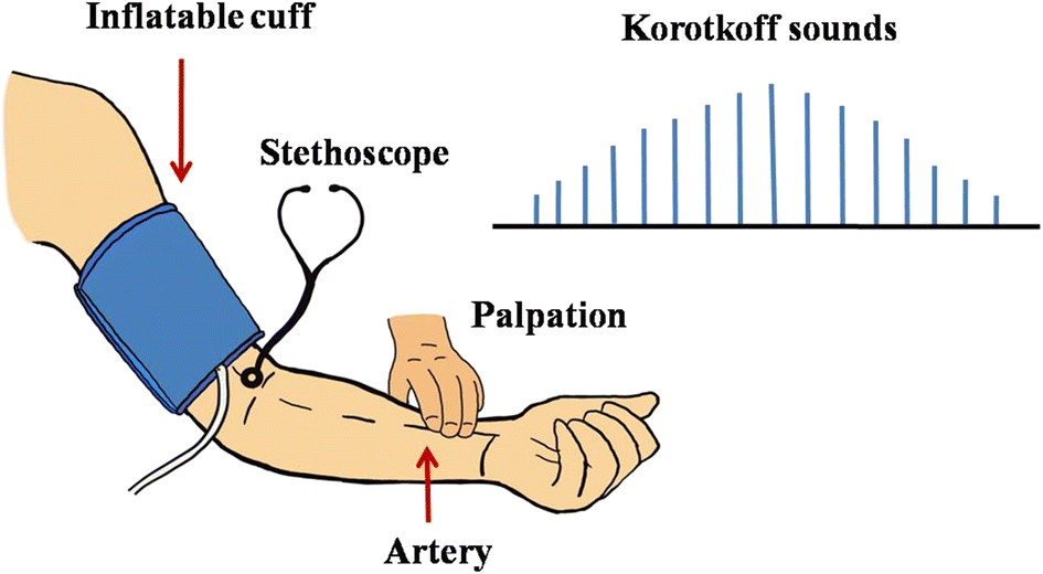Blood pressure measurement techniques, standards, technologies, and the latest futuristic