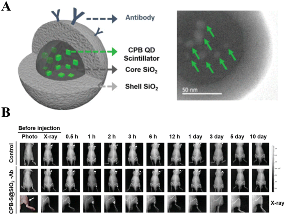 Bioengineered nanomaterials for dynamic diagnostics in vivo - Chemical Society Reviews (RSC Publishing) DOI:10.1039/D5CS00136F Bioengineered nanomaterials for dynamic diagnostics in vivo - Chemical Society Reviews (RSC Publishing) DOI:10.1039/D5CS00136F
