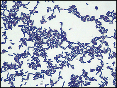 CHAPTER 1 Treatment ofClostridium difficileInfections (RSC Publishing ...