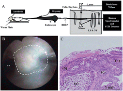 Graphical abstract: Raman endoscopy for the in situ investigation of advancing colorectal tumors in live model mice