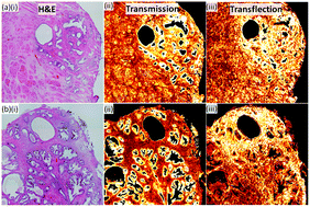 Graphical abstract: Comparison of transmission and transflectance mode FTIR imaging of biological tissue