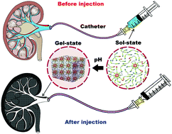 Graphical abstract: pH-Sensitive sulfamethazine-based hydrogels as potential embolic agents for transcatheter vascular embolization