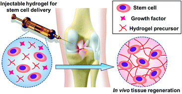 Graphical abstract: Recent advances in the design of injectable hydrogels for stem cell-based therapy