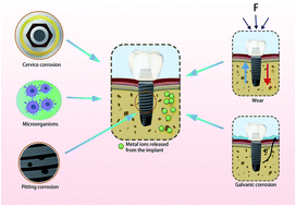 Graphical abstract: Impact of exogenous metal ions on peri-implant bone metabolism: a review