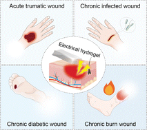 Graphical abstract: Electrical hydrogel: electrophysiological-based strategy for wound healing