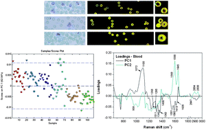 Graphical abstract: Raman spectroscopic analysis of malaria disease progression via blood and plasma samples