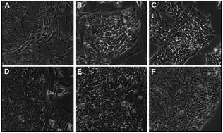 Graphical abstract: Fourier transform infrared microspectroscopy reveals that tissue culture conditions affect the macromolecular phenotype of human embryonic stem cells