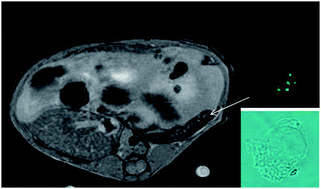 Graphical abstract: Paramagnetic nanoparticles to track and quantify in vivo immune human therapeutic cells