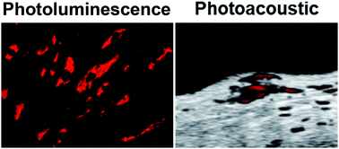 Graphical abstract: Silicon carbide nanoparticles as a photoacoustic and photoluminescent dual-imaging contrast agent for long-term cell tracking