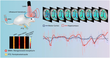 Graphical abstract: Real-time visualization of epileptic seizures using photoacoustic imaging with a peroxynitrite-responsive manganese(ii) texaphyrin