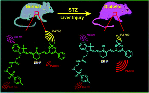 Graphical abstract: Ratiometric photoacoustic imaging of endoplasmic reticulum polarity in injured liver tissues of diabetic mice