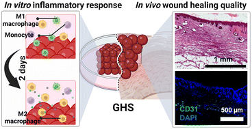 Graphical abstract: Gelatin methacryloyl granular hydrogel scaffolds for skin wound healing