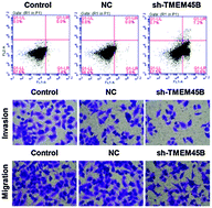 Graphical abstract: TMEM45B promotes proliferation, invasion and migration and inhibits apoptosis in pancreatic cancer cells