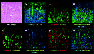 Graphical abstract: Dual polarity MALDI imaging mass spectrometry on the same pixel points reveals spatial lipid localizations at high-spatial resolutions in rat small intestine