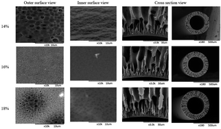 Graphical abstract: Selectively mixed matrix hemodialysis membrane for adequate clearance of p-cresol by the incorporation of imprinted zeolite