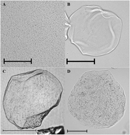 Graphical abstract: Microencapsulation of probiotics in hydrogel particles: enhancing Lactococcus lactis subsp. cremoris LM0230 viability using calcium alginate beads