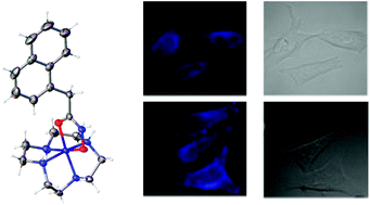 Graphical abstract: The influence of the ancillary ligand on the potential of cobalt(iii) complexes to act as chaperones for hydroxamic acid-based drugs