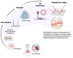 Graphical abstract: Integrating microfluidics, hydrogels, and 3D bioprinting for personalized vessel-on-a-chip platforms