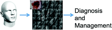 Graphical abstract: Reflectance confocal microscopy in the diagnosis of pigmented macules of the face: differential diagnosis and margin definition