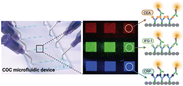 Graphical abstract: Laser-assisted protein micropatterning in a thermoplastic device for multiplexed prostate cancer biomarker detection