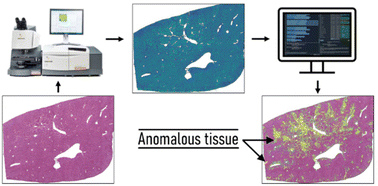 Graphical abstract: Weakly supervised anomaly detection coupled with Fourier transform infrared (FT-IR) spectroscopy for the identification of non-normal tissue