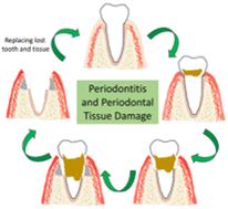 Graphical abstract: Polymeric biomaterials for periodontal tissue engineering and periodontitis