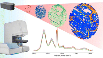Graphical abstract: Full fingerprint hyperspectral imaging of prostate cancer tissue microarrays within clinical timeframes using quantum cascade laser microscopy
