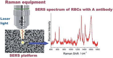 Graphical abstract: ABO blood groups' antigen–antibody interactions studied using SERS spectroscopy: towards blood typing