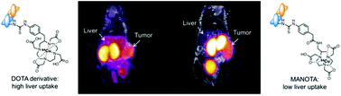 Graphical abstract: MANOTA: a promising bifunctional chelating agent for copper-64 immunoPET