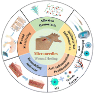 Graphical abstract: Microneedles: a novel strategy for wound management