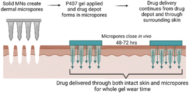 Graphical abstract: Thermosensitive biomaterial gels with chemical permeation enhancers for enhanced microneedle delivery of naltrexone for managing opioid and alcohol dependency