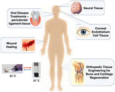 Graphical abstract: Thermoresponsive polymers with LCST transition: synthesis, characterization, and their impact on biomedical frontiers