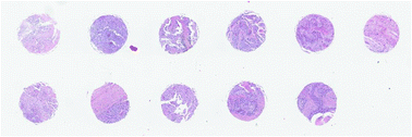 Graphical abstract: A method for the comparison of multi-platform spectral histopathology (SHP) data sets