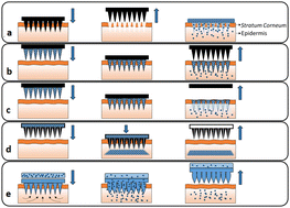 Graphical abstract: Recent progress in PLGA-based microneedle-mediated transdermal drug and vaccine delivery