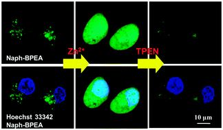 Graphical abstract: In vitro and in vivo imaging application of a 1,8-naphthalimide-derived Zn2+ fluorescent sensor with nuclear envelope penetrability