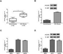 Graphical abstract: Retracted Article: Down-regulation of HOXB5 inhibits TGF-β-induced migration and invasion in hepatocellular carcinoma cells via inactivation of the PI3K/Akt pathway