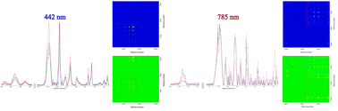 Graphical abstract: Two-dimensional correlation spectroscopy (2D-COS) in the analysis of parasitemia in Raman spectra of red blood cells of patients diagnosed with malaria
