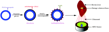 Graphical abstract: Au nanoparticle-coated, PLGA-based hybrid capsules for combined ultrasound imaging and HIFU therapy