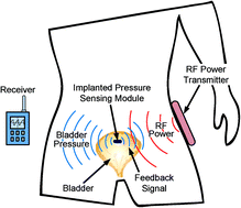 Graphical abstract: Implantable wireless battery recharging system for bladder pressure chronic monitoring