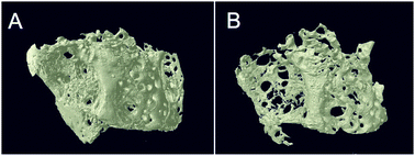 Graphical abstract: Enzymatically regulated demineralisation of pathological bone using sodium hexametaphosphate