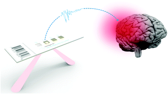 Graphical abstract: Developing infrared spectroscopic detection for stratifying brain tumour patients: glioblastoma multiforme vs. lymphoma