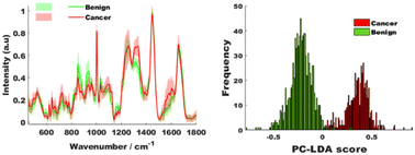 Graphical abstract: Raman spectroscopy of ovarian and peritoneal tissue in the assessment of ovarian cancer