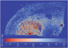 Graphical abstract: Elemental bio-imaging using laser ablation-triple quadrupole-ICP-MS