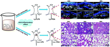 Graphical abstract: Polydopamine nanoparticles for the treatment of acute inflammation-induced injury