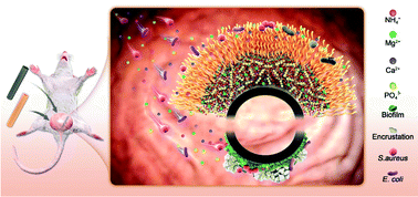 Graphical abstract: Bio-inspired antibacterial coatings on urinary stents for encrustation prevention