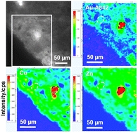 Graphical abstract: Immunogold labeling and X-ray fluorescence microscopy reveal enrichment ratios of Cu and Zn, metabolism of APP and amyloid-β plaque formation in a mouse model of Alzheimer's disease